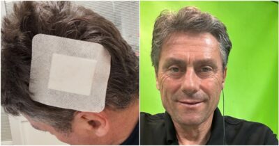 Copertina di “Investito da un’auto non assicurata, ho saltato sul cofano e stupito i medici. C’è una maleducazione imperante e intollerabile”: lo sfogo di Silvio Martinello