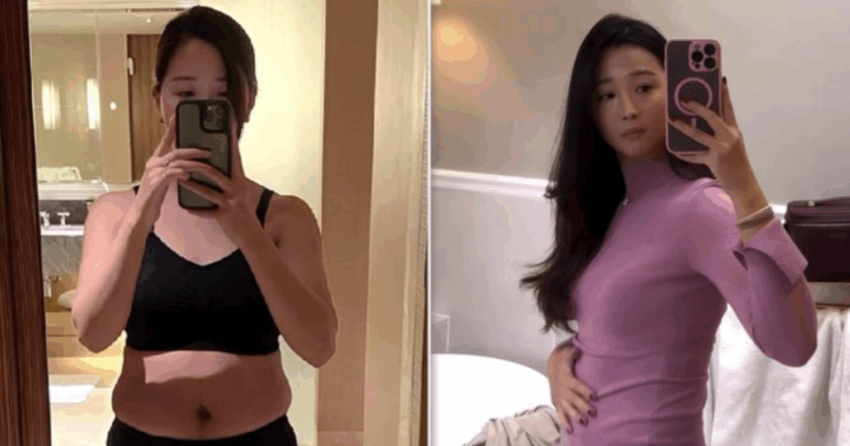 “Mi sono sottoposta a sei interventi di chirugia estetica in una settimana, compresa una vaginoplastica. Ho speso oltre 19 mila euro e ora vengo attaccata sui social”: la storia di Glory Lu