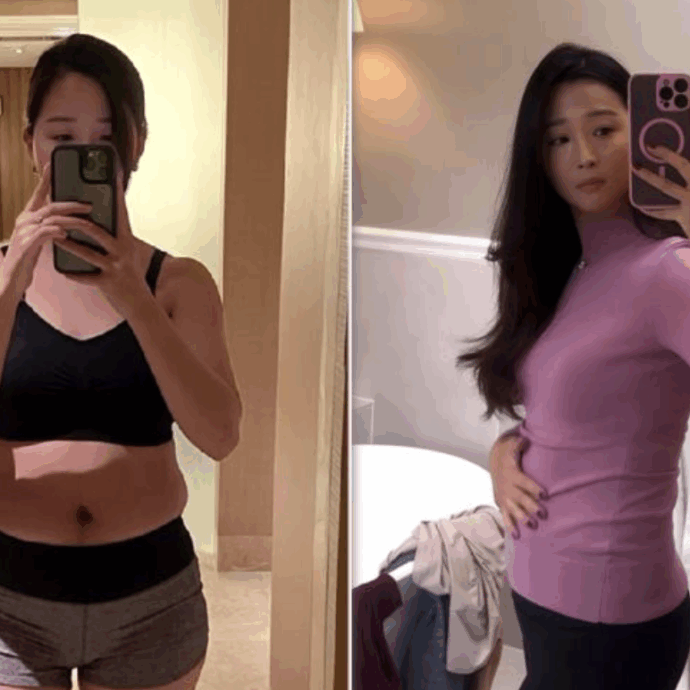 “Mi sono sottoposta a sei interventi di chirugia estetica in una settimana, compresa una vaginoplastica. Ho speso oltre 19 mila euro e ora vengo attaccata sui social”: la storia di Glory Lu