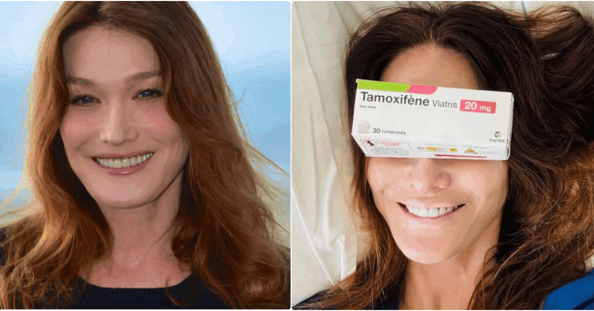 Carla Bruni finisce le cure e dice addio al cancro: “La terapia ormonale ha effetti collaterali aggressivi, ma può salvare la vita. Fate i controlli ogni anno”