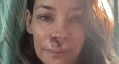 Copertina di “Ho danni cerebrali dopo una caduta in spiaggia. Tutte le aree del mio cervello funzionano a capacità ridotta”: la confessione di Evangeline Lilly