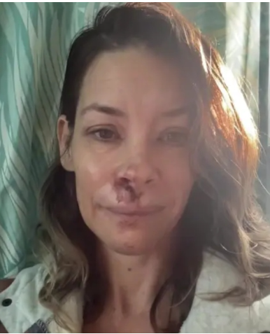 “Ho danni cerebrali dopo una caduta in spiaggia. Tutte le aree del mio cervello funzionano a capacità ridotta”: la confessione di Evangeline Lilly
