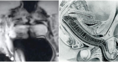 Copertina di “Il pene eretto può assumere la forma di un boomerang per adattarsi alla forma della vagina”: coppia fa sesso in una macchina per risonanze magnetiche