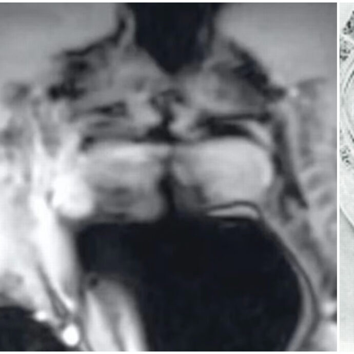 “Il pene eretto può assumere la forma di un boomerang per adattarsi alla forma della vagina”: coppia fa sesso in una macchina per risonanze magnetiche