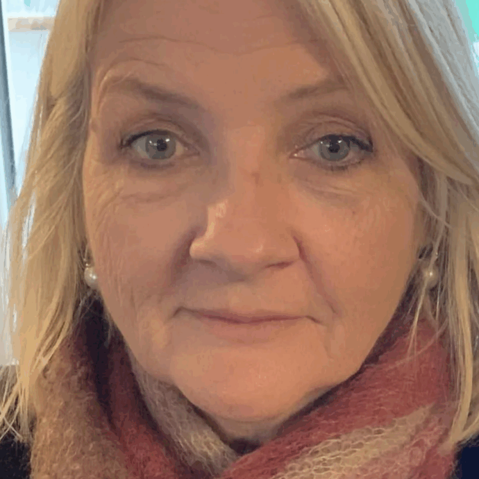 “Mi sono ustionata con il caffè in aereo, è stato uno choc assoluto. Le hostess non avevano nulla per medicarmi”: Denise Elliot fa causa a Ryanair e ottiene un risarcimento di oltre 4 mila euro