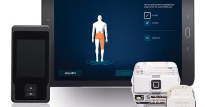 Copertina di A Verona primo trattamento in Europa per il dolore cronico con elettrodi