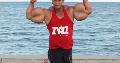 Copertina di È morto a 55 anni Arlindo de Souza, il bodybuilder “Anomalia” dai bicipiti “giganteschi”: “Ucciso dalle iniezioni di Synthol”