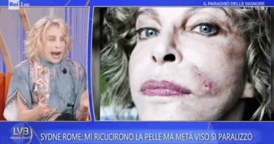 Copertina di “Ho avuto una paralisi facciale per anni. Per un’attrice significa non lavorare. Dopo 20 anni di fisioterapia, la svolta”: lo rivela Sydne Rome