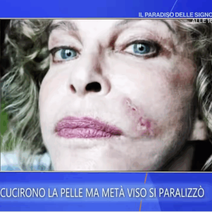 “Ho avuto una paralisi facciale per anni. Per un’attrice significa non lavorare. Dopo 20 anni di fisioterapia, la svolta”: lo rivela Sydne Rome