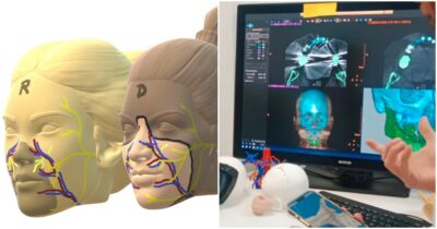 Copertina di Spagna, primo trapianto parziale di volto da una donatrice che aveva scelto l’eutanasia