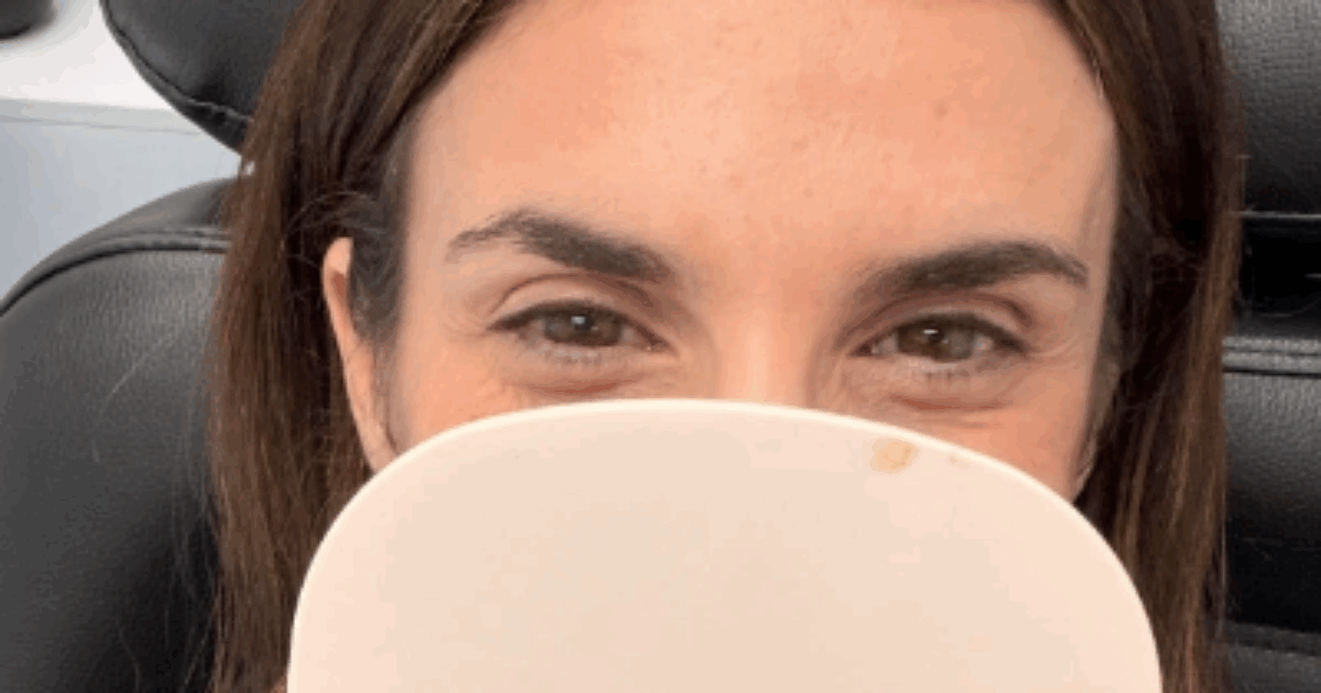 Cos’è il Prf, il segreto di bellezza delle star da Hailey Bieber a Elisabetta Canalis: come funziona il trattamento, quali sono i benefici e quali i rischi