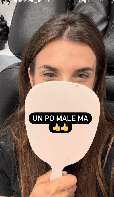 Cos’è il Prf, il segreto di bellezza delle star da Hailey Bieber a Elisabetta Canalis: come funziona il trattamento, quali sono i benefici e quali i rischi