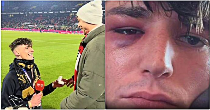 Picchiato sotto casa l’arbitro Kaiser: una settimana fa la proposta di matrimonio al compagno prima della gara di Bundesliga