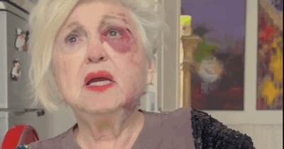 Copertina di Wanna Marchi investita da un’auto sulle strisce: “La mia faccia è stravolta, i sassi mi sono penetrati ovunque, ho sbattuto sul marciapiede. Sono devastata”