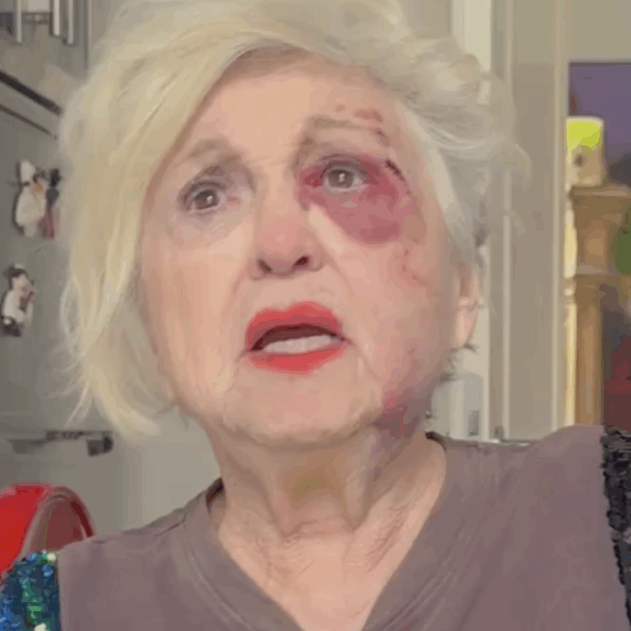 Wanna Marchi investita da un’auto sulle strisce: “La mia faccia è stravolta, i sassi mi sono penetrati ovunque, ho sbattuto sul marciapiede. Sono devastata”