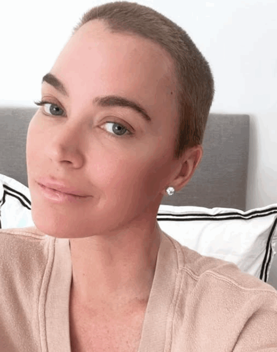 “Il tumore è sparito, ora sto lavorando per ritrovare me stessa. Le parole di mio padre? Ha ragione”: la confessione di Teddi Mellencamp