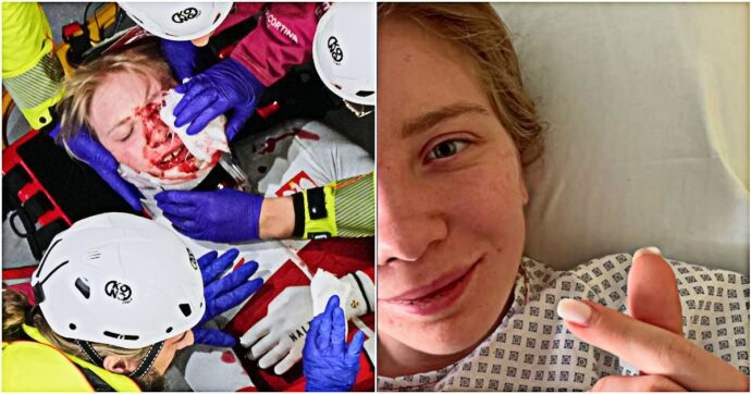 “Guarderò questa foto e ricorderò che sono stata più forte di quanto credessi”: la prima foto di Sellier dopo il taglio al volto