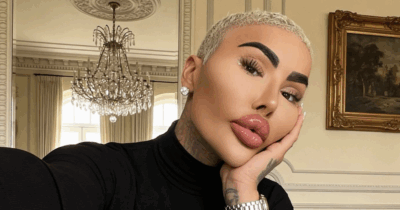 Copertina di È morto il “re delle labbra” Jordan James Parke dopo un intervento: due arresti per omicidio colposo. La vittima ha speso oltre 150mila dollari in chirurgia plastica