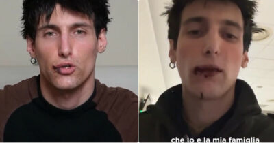 Copertina di “Urlava che avrebbe ammazzato mia mamma, mia sorella e portato via mia nipote. Ci minaccia da un anno ma è ancora libero”: il creator Leo Mel mostra i segni dell’aggressione