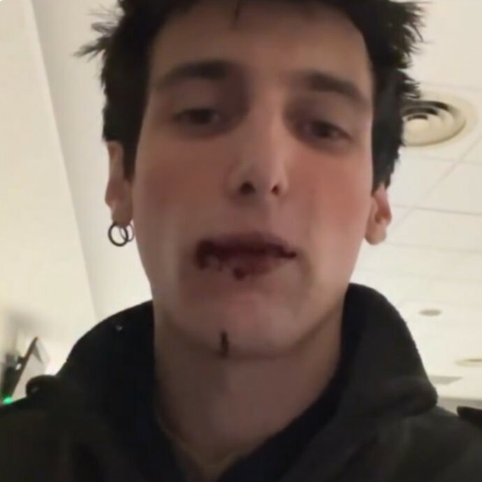 “Urlava che avrebbe ammazzato mia mamma, mia sorella e portato via mia nipote. Ci minaccia da un anno ma è ancora libero”: il creator Leo Mel mostra i segni dell’aggressione