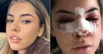 Copertina di “Tre anni per vedere in carcere il mio ex fidanzato dopo le violenze che ho subito. Oggi l’ennesimo sconto di pena. Questo Paese fa schifo”: lo sfogo di Chiara Balistreri