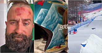 Copertina di Riccardo Cardani: “Non ho danni, il casco mi ha salvato la vita”. Il video della caduta dello snowboarder paralimpico