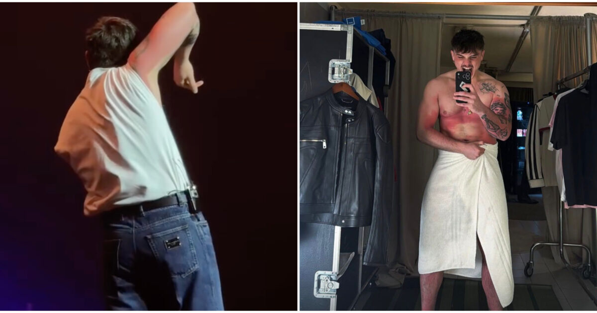 “Mi hanno detto ‘sei un cadavere, fai cag**re, devi farti una lampada. Mi sono ustionato, non me ne frega un ca**o”: Olly rivela il piccolo “incidente” sul palco