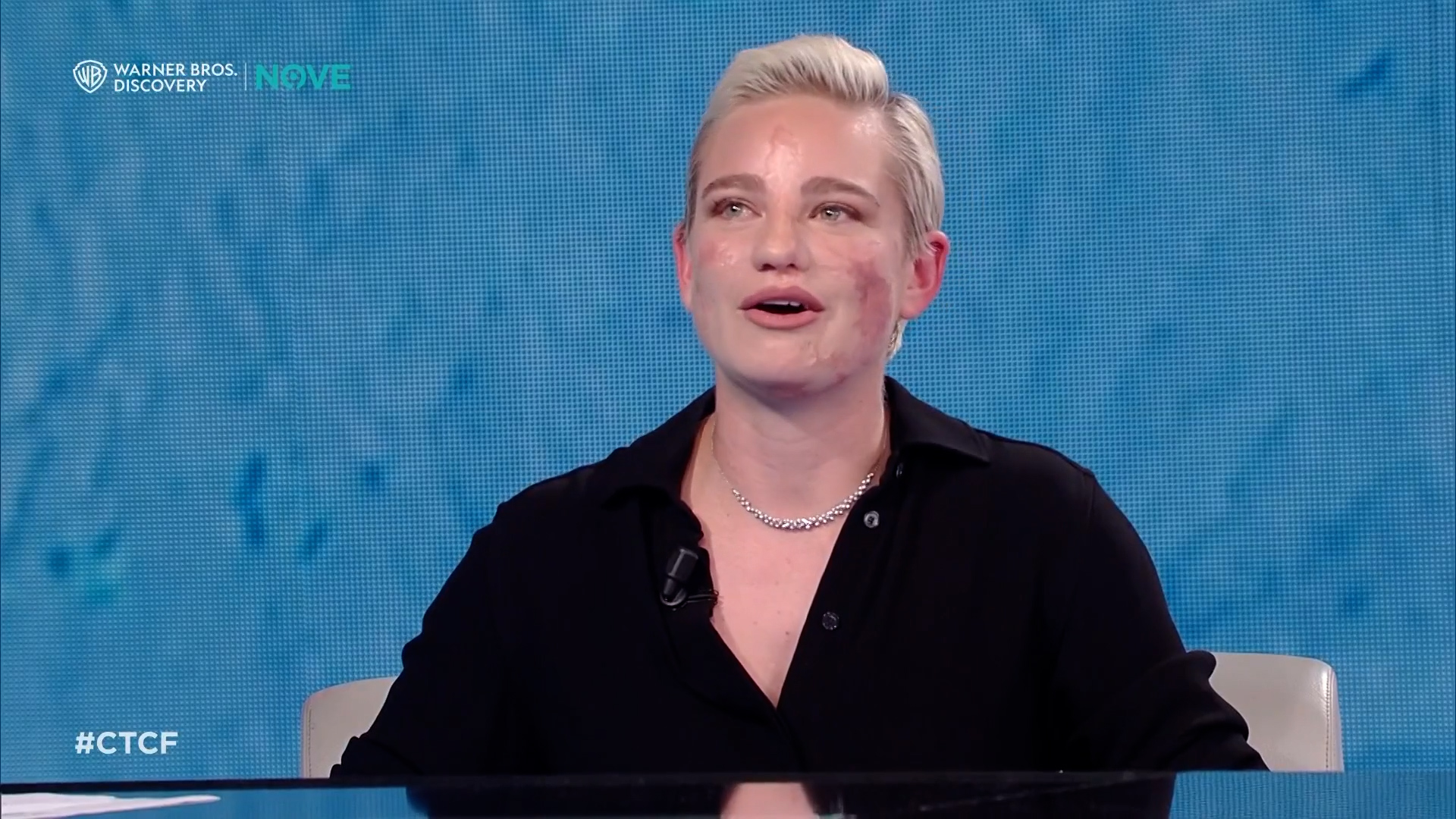 “È finita con la scherma, non ce la faccio più fisicamente. Ho iniziato con l’atletica”: l’annuncio di Bebe Vio a Che tempo che fa