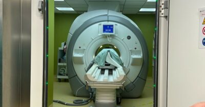 Copertina di Addio al tremore senza bisturi: la rivoluzione degli ultrasuoni al Besta. Efficace contro il Parkinson, promettente contro tumori cerebrali e Alzheimer