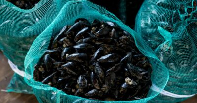 Copertina di Napoli, allarme epatite: i ricoverati saliti a 53