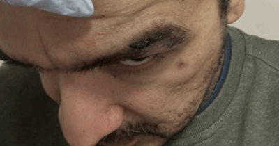 Copertina di “Hanno urlato ‘paki, sabbia negra e sporco arabo’. Mi hanno colpito in pieno e aperto la testa fino al cranio”: Boyan Chowdhury, ex chitarrista degli Zutons, si sfoga