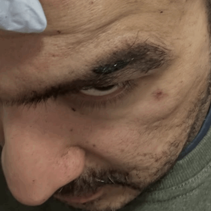 “Hanno urlato ‘paki, sabbia negra e sporco arabo’. Mi hanno colpito in pieno e aperto la testa fino al cranio”: Boyan Chowdhury, ex chitarrista degli Zutons, si sfoga