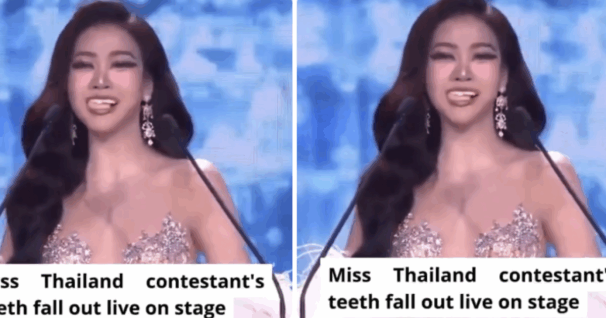 Parla sul palco in abito da sera quando all’improvviso perde i denti: il video della candidata a Miss Grand Thailand è virale