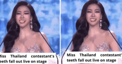 Copertina di Parla sul palco in abito da sera quando all’improvviso perde i denti: il video della candidata a Miss Grand Thailand è virale