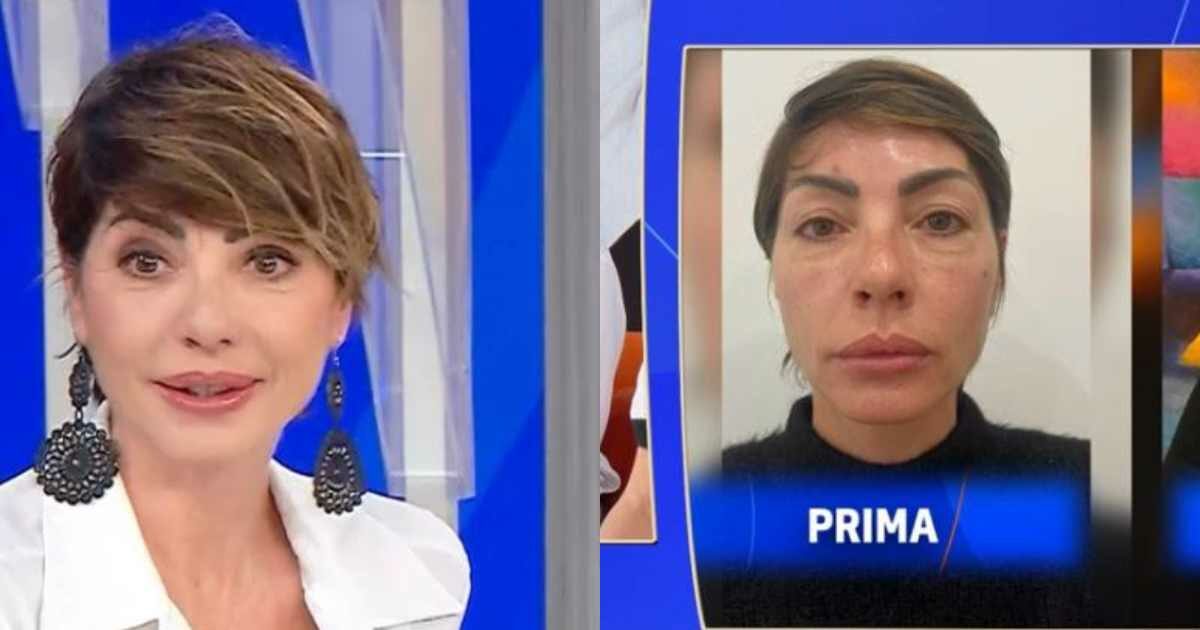 “Ho fatto la blefaroplastica e mi hanno riempita di insulti. Mi hanno scritto ‘sei un mostro, poveri figli’, ma non mi vergogno. Sono vanitosa e voglio farne già un’altra”: così Ilaria Galassi