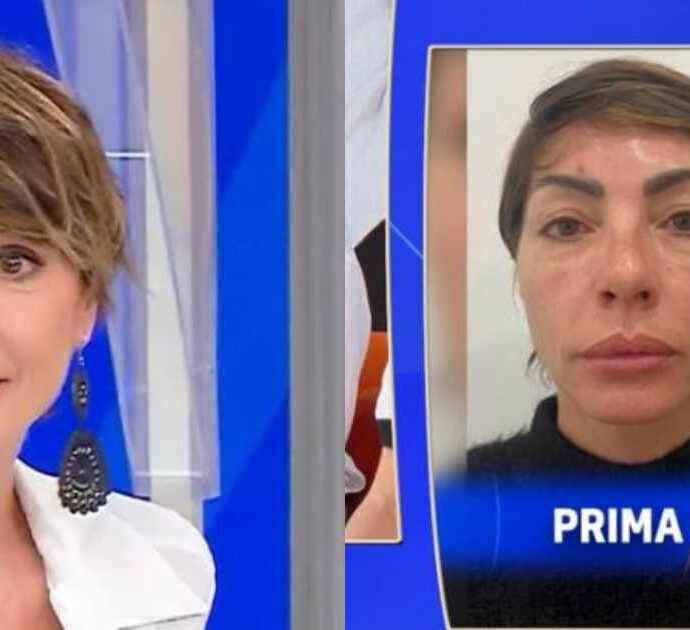 “Ho fatto la blefaroplastica e mi hanno riempita di insulti. Mi hanno scritto ‘sei un mostro, poveri figli’, ma non mi vergogno. Sono vanitosa e voglio farne già un’altra”: così Ilaria Galassi