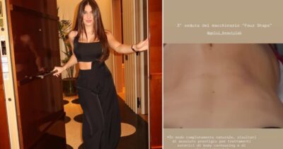 Copertina di Cos’è il body contouring, il trattamento per assottigliare il punto vita fatto da Chanel Totti: “Rischio di emualzione delle coetanee, di solito lo fa chi ha problemi di lassità cutanea”