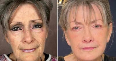 Copertina di “Sono quasi morta per un’embolia polmonare . Il mio volto ero solo pelle e ossa, ora invece dimostro 30 anni di meno. Ho dovuto ricredermi sulla chirurgia estetica”: la storia di Mae