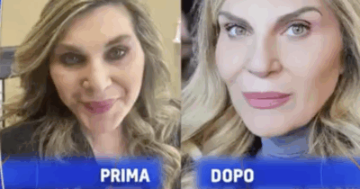 Copertina di “Dopo i 50 anni la mascella scende. Mi è ritornata la punta, che non vedevo più perché ero diventata un po’ quadrata”: Nadia Rinaldi sul lifting al viso e intervento al naso