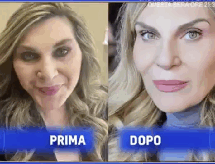 “Dopo i 50 anni la mascella scende. Mi è ritornata la punta, che non vedevo più perché ero diventata un po’ quadrata”: Nadia Rinaldi sul lifting al viso e intervento al naso