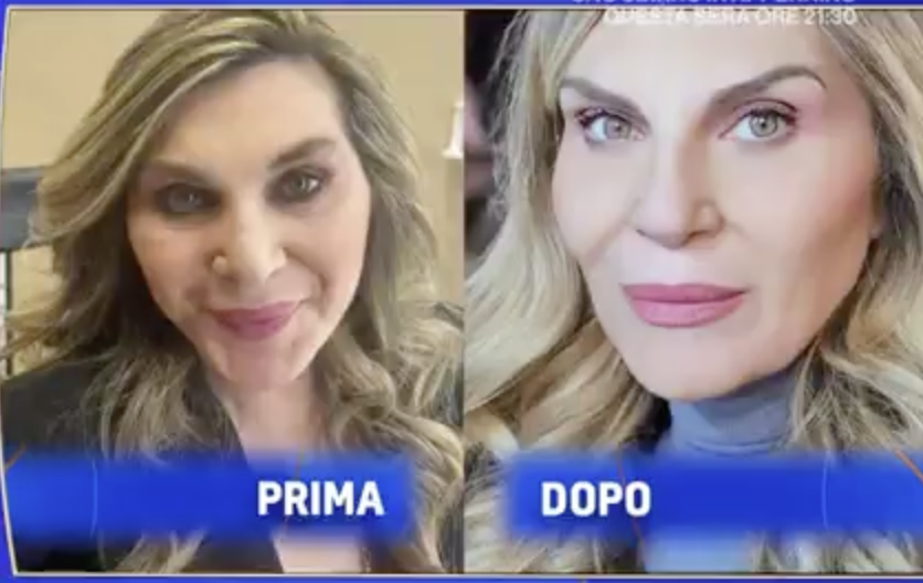 “Dopo i 50 anni la mascella scende. Mi è ritornata la punta, che non vedevo più perché ero diventata un po’ quadrata”: Nadia Rinaldi sul lifting al viso e intervento al naso