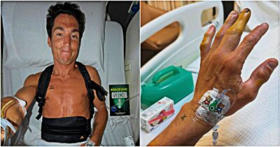 Copertina di Aleix Espargaró pubblica le foto dal letto d’ospedale: “Incidente molto pesante, ho quattro vertebre rotte”