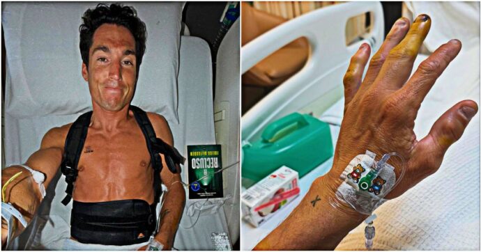 Aleix Espargaró pubblica le foto dal letto d’ospedale: “Incidente molto pesante, ho quattro vertebre rotte”