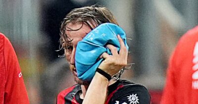 Copertina di Tegola Milan, stagione finita per Modric: si è operato per la frattura allo zigomo. Corsa contro il tempo per i Mondiali