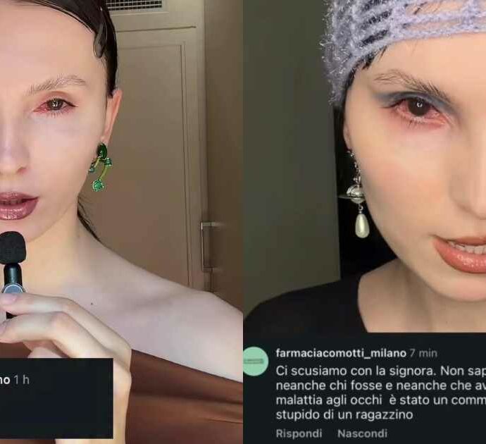 Il profilo di una farmacia scrive “che mostro” a una modella con disabilità visiva: infuriano le polemiche. Poi le scuse: “È stato un commento stupido di un ragazzino”