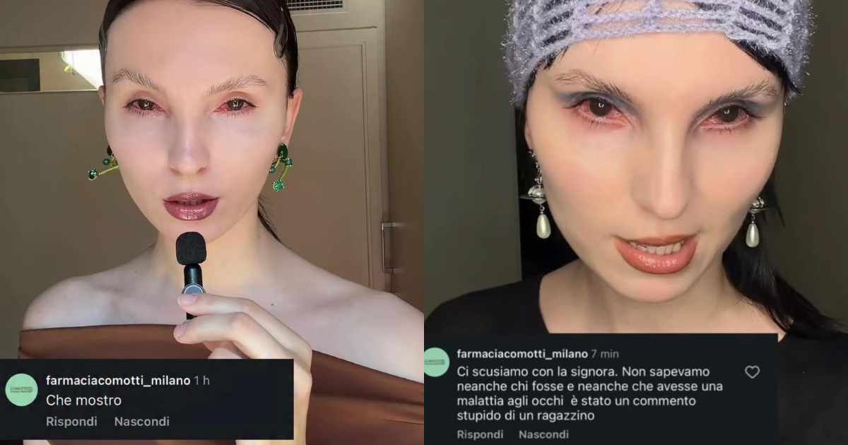 Il profilo di una farmacia scrive “che mostro” a una modella con disabilità visiva: infuriano le polemiche. Poi le scuse: “È stato un commento stupido di un ragazzino”