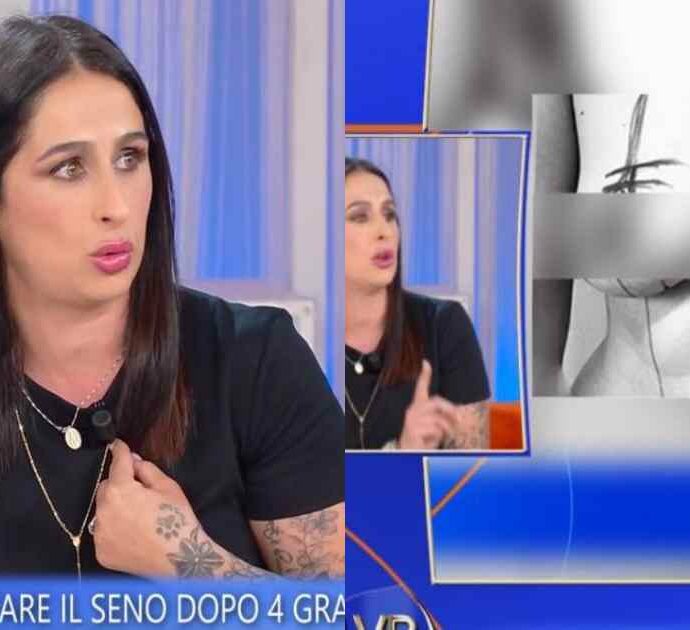 “Vivo un incubo da tre anni, ho speso 8mila euro per un intervento al seno e oggi non posso nemmeno andare al mare”: la storia di Angie Cozzolino