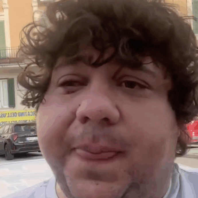 “Mi hanno spaccato di botte a San Lorenzo. Mi hanno tirato dei calci in testa. Sono dei pezzi di me*da”: lo sfogo del rapper Ozymandias in ospedale