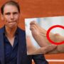 Copertina di “Dicevano che non avrei mai più giocato. Non era solo una piccola crepa, è una malattia”: la foto del piede deformato di Nadal. Cos’è la sindrome di Müller-Weiss