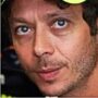 Copertina di Ambra Arpino: “Le donne di Valentino Rossi mi hanno aggredito, sono dovuta andare all’ospedale”. Le nuove accuse della compagna di Graziano